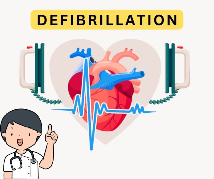 Why is defibrillation important bls