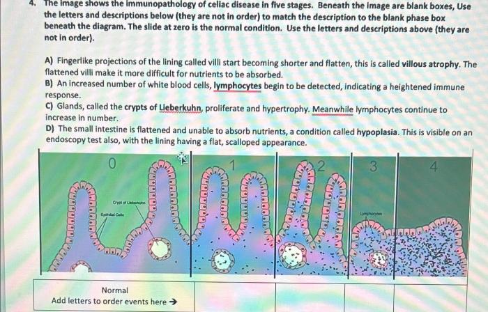 Match the condition with the available descriptions lymphoma